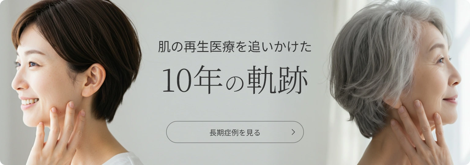 「10年前と全然変わらないね」と言われたい方へ|長期症例を見る