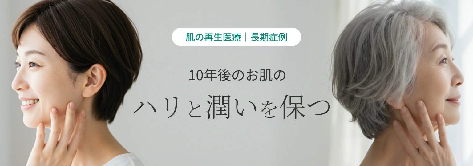 「肌の再生医療|長期症例」10年後のお肌のハリと潤いを保つ